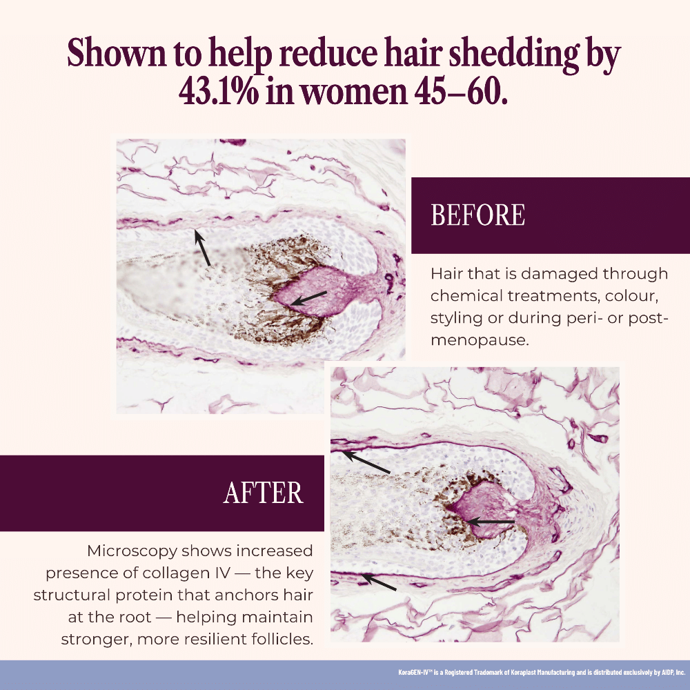 529541181